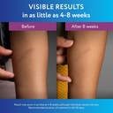 scaraway-silicone-scar-gel-helps-improve-5.jpg