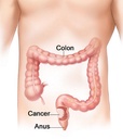miracle-oxy-colon-cleanse-vegan-colon-cl-5.jpg