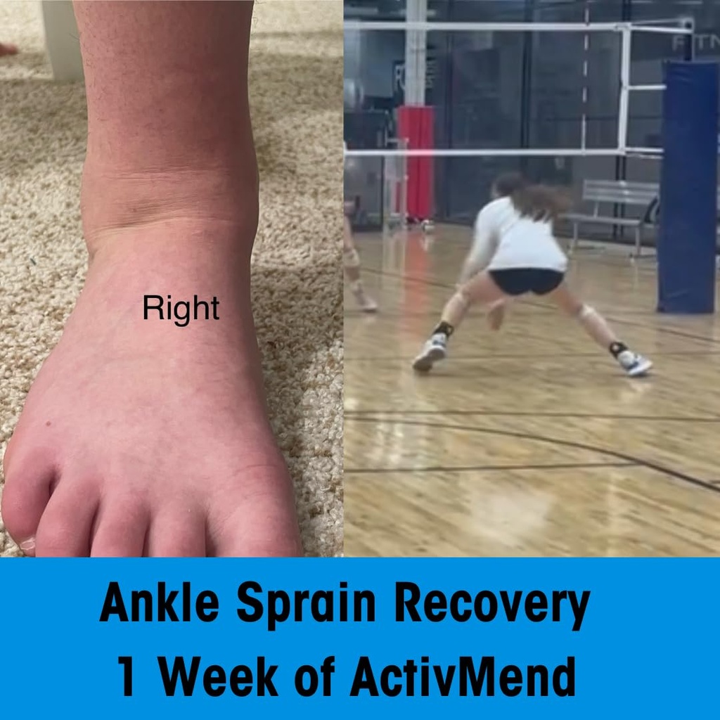 ankle-sprain-recovery-patches-helps-spee-3.jpg