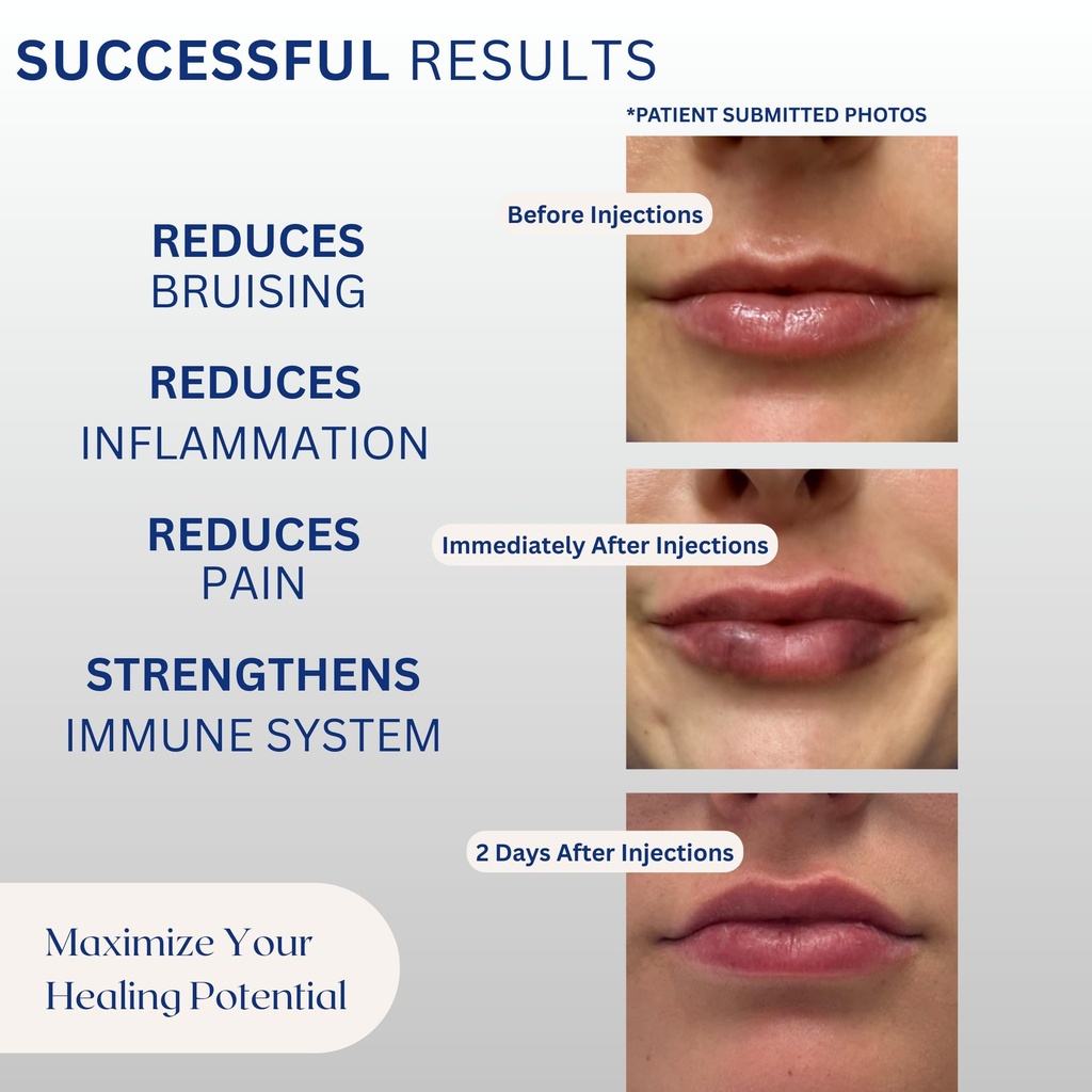 bruising-swelling-support-supplement-adv-3.jpg