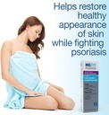 mg217-medicated-moisturizing-psoriasis-c-4.jpg