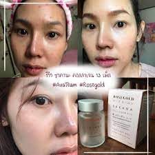 rosegold-sakana-collagen-x-10-5.jpg