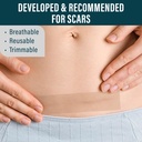 nuvadermis-silicone-scar-tape-for-surgic-3.jpg