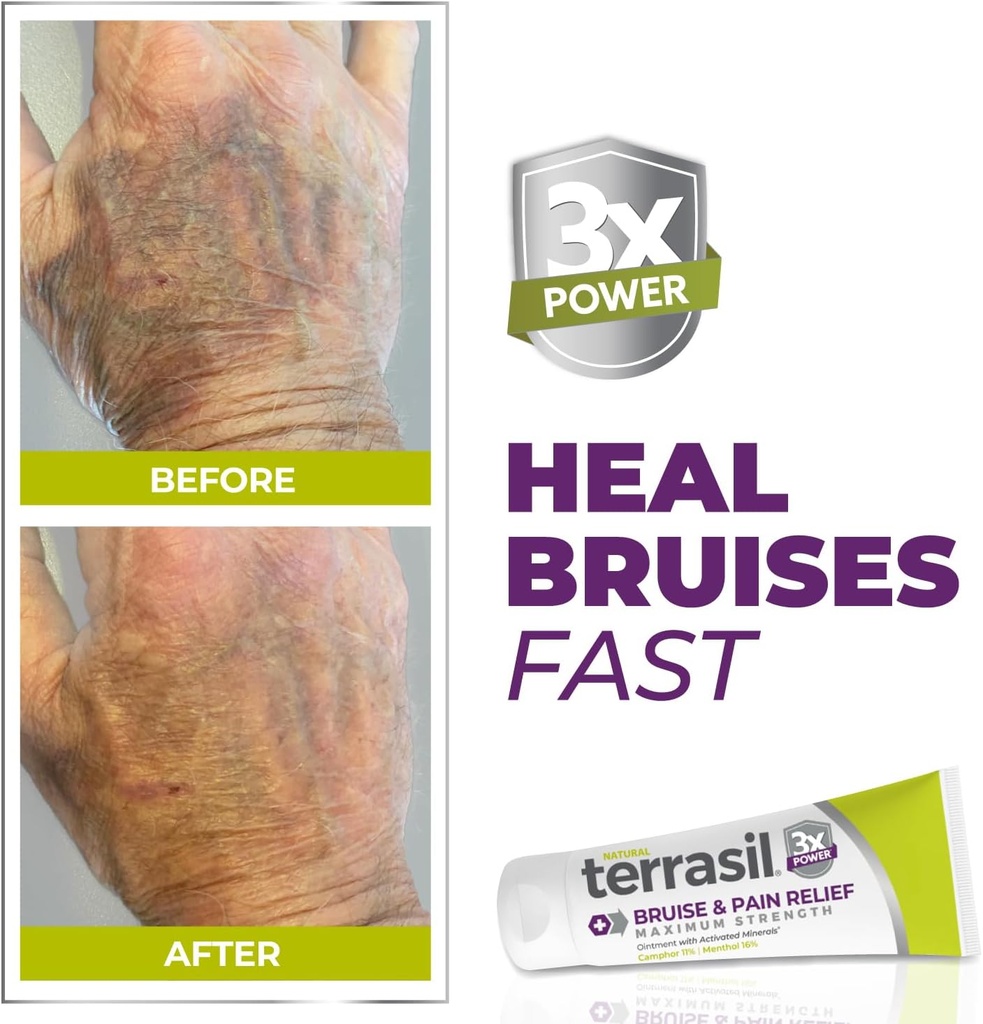 terrasil-bruise-cream-for-thin-skin-brui-2.jpg