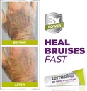 terrasil-bruise-cream-for-thin-skin-brui-2.jpg