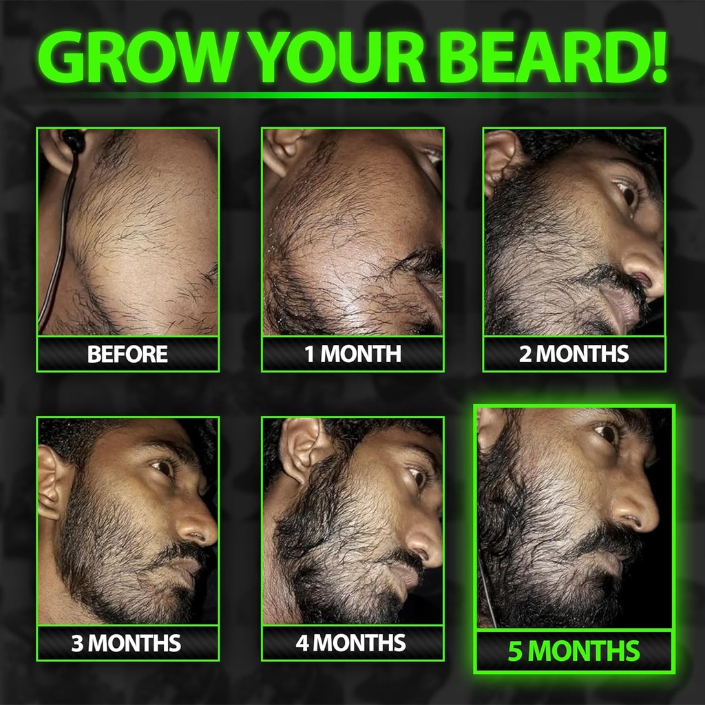beard-growth-kit-wgrow-xxl-beard-oilseru-3.jpg