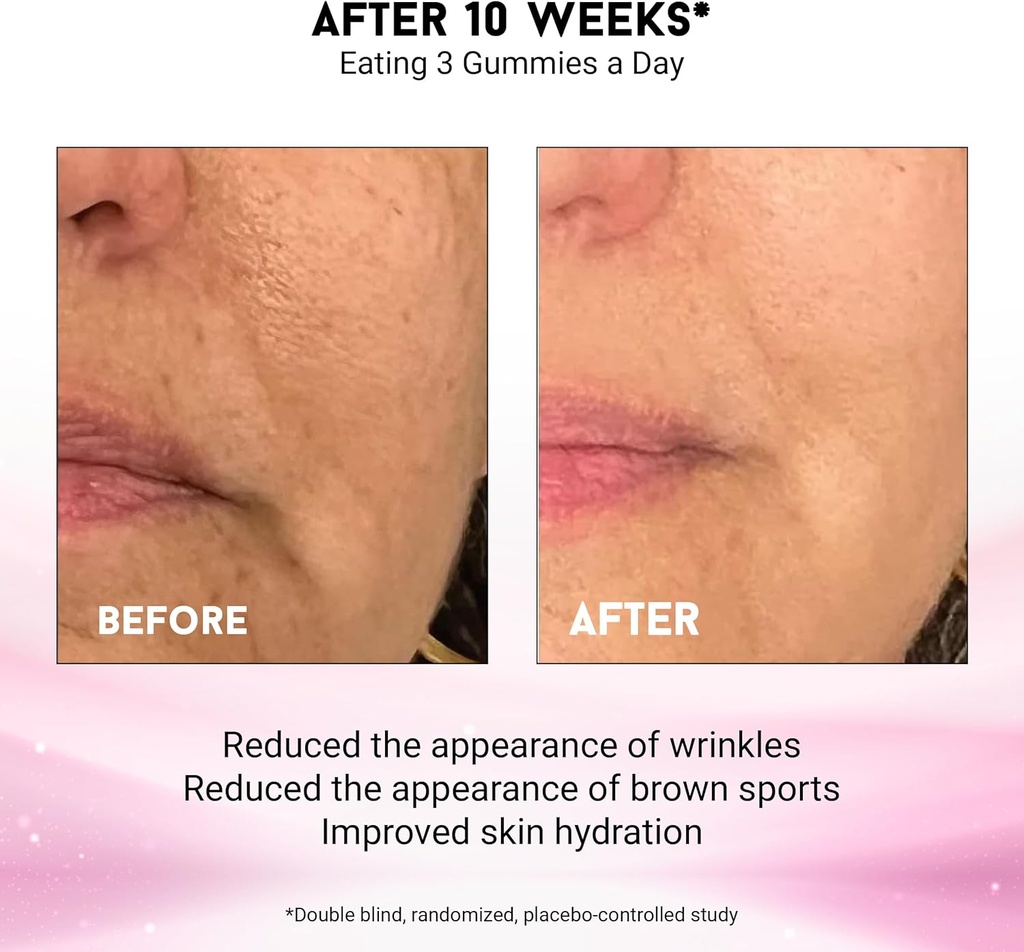 joyce-giraud-ultimate-beauty-gummies-30--6.jpg