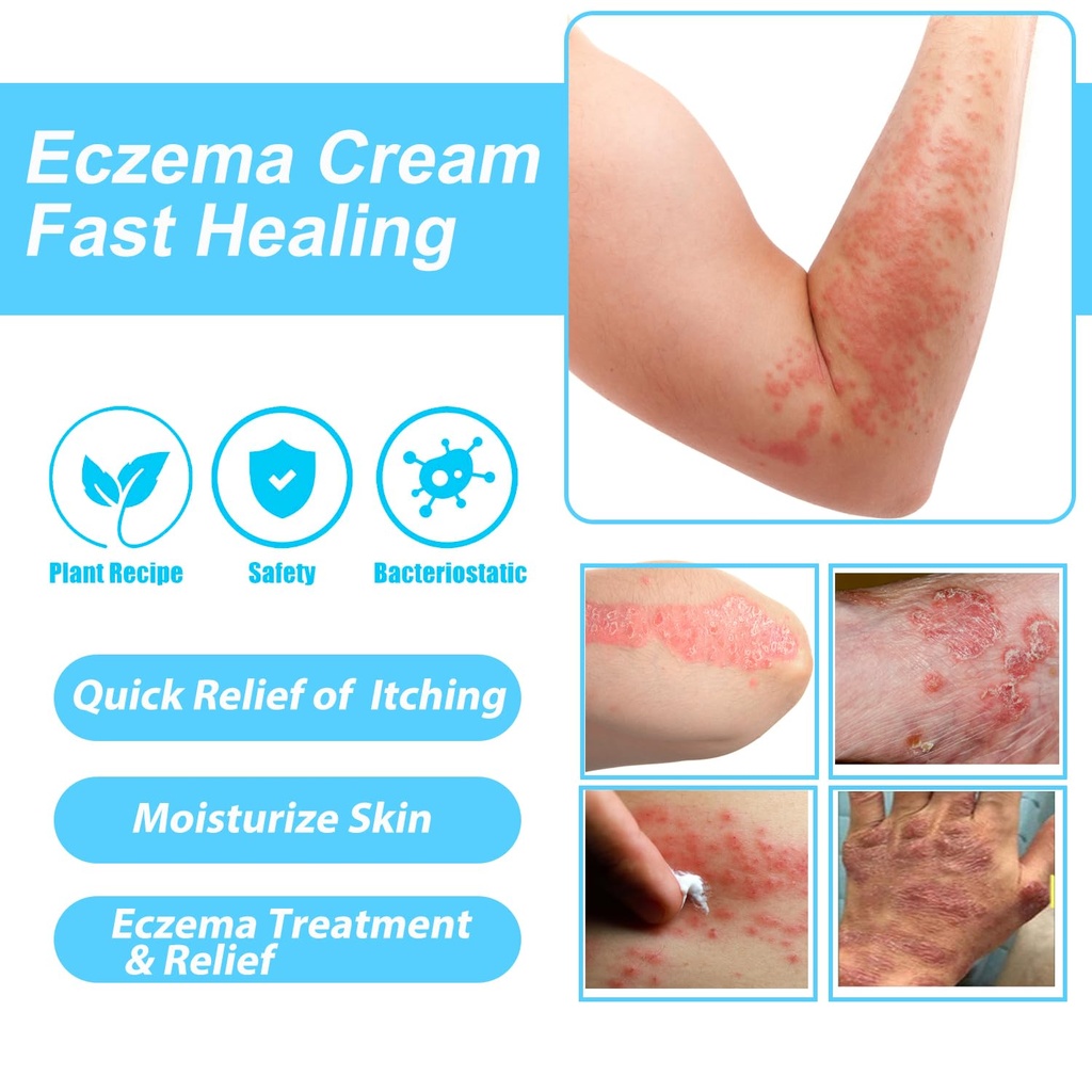 healmusz-eczema-relief-creamy-body-oil-p-2.jpg