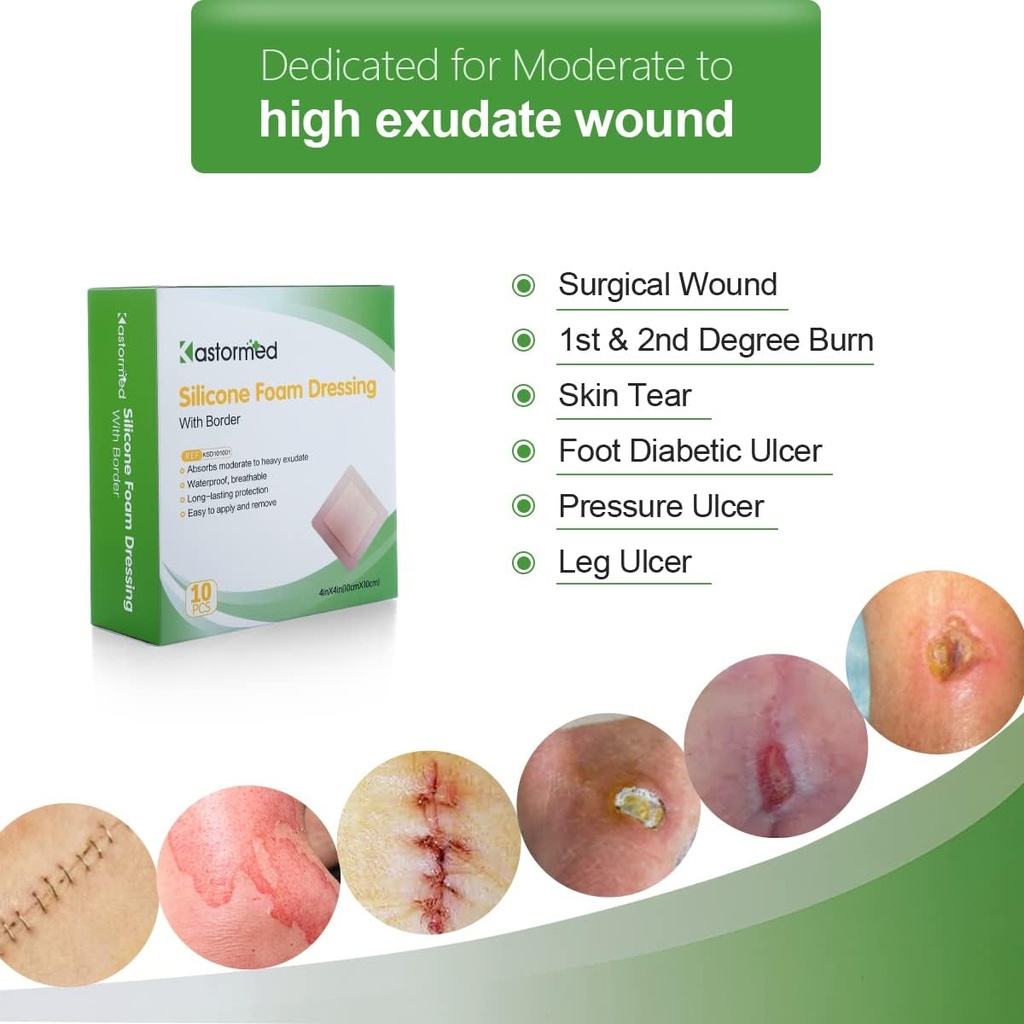 kastormed-silicone-adhesive-foam-dressin-2.jpg
