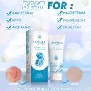 baby-eczema-cream-for-dry-itchy-skin-soo-2.jpg