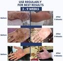psodex-eczema-cream-moisturizing-eczema--4.jpg