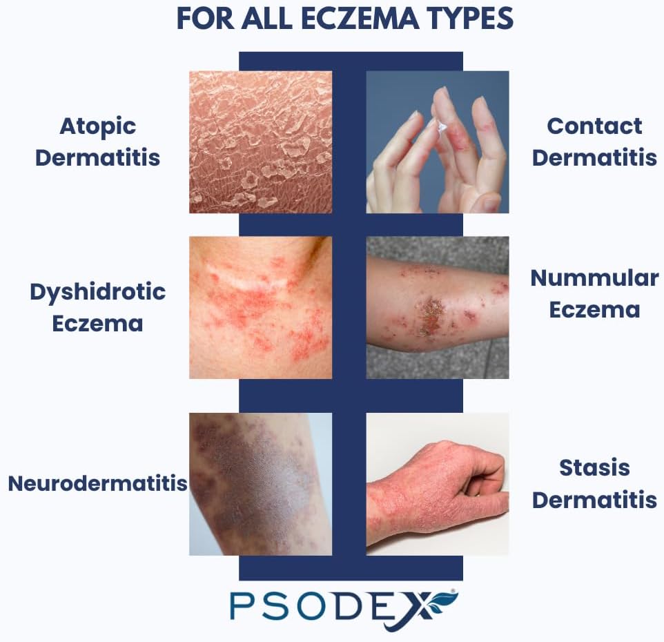 psodex-eczema-cream-moisturizing-eczema--5.jpg