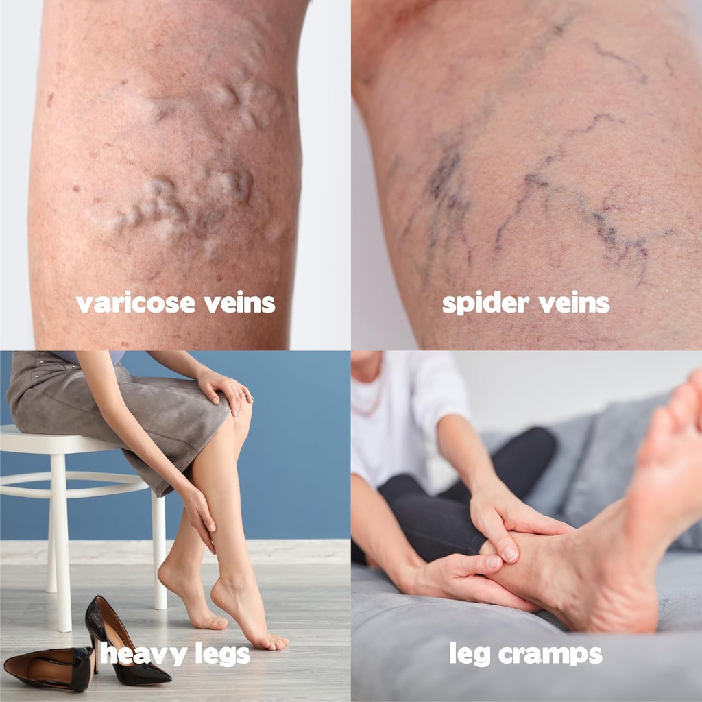 hillvital-varicose-veins-treatment-for-l-3.jpg