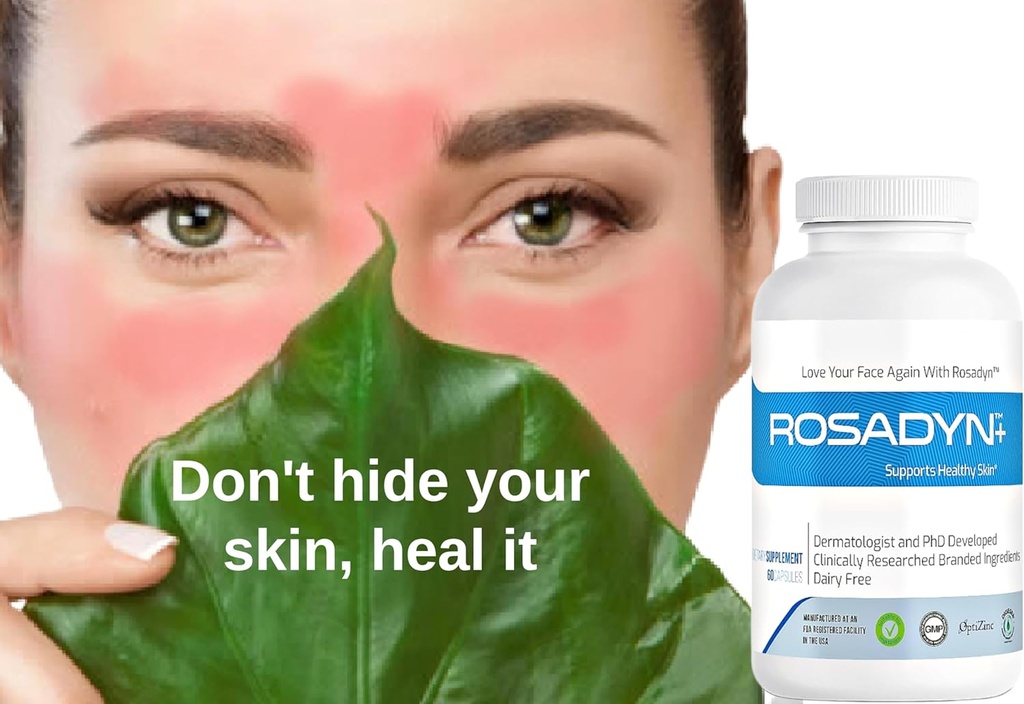 rosacea-skin-care-supplement-for-redness-5.jpg