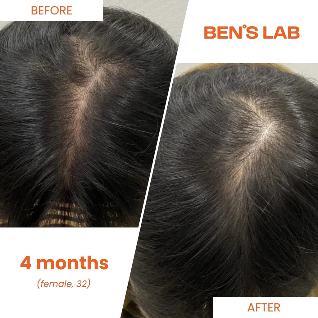bens-lab-hair-growth-thickness-supplemen-5.jpg