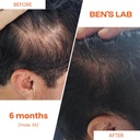 bens-lab-hair-growth-thickness-supplemen-6.jpg