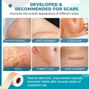 silicone-scar-sheets-silicone-scar-tape1-3.jpg