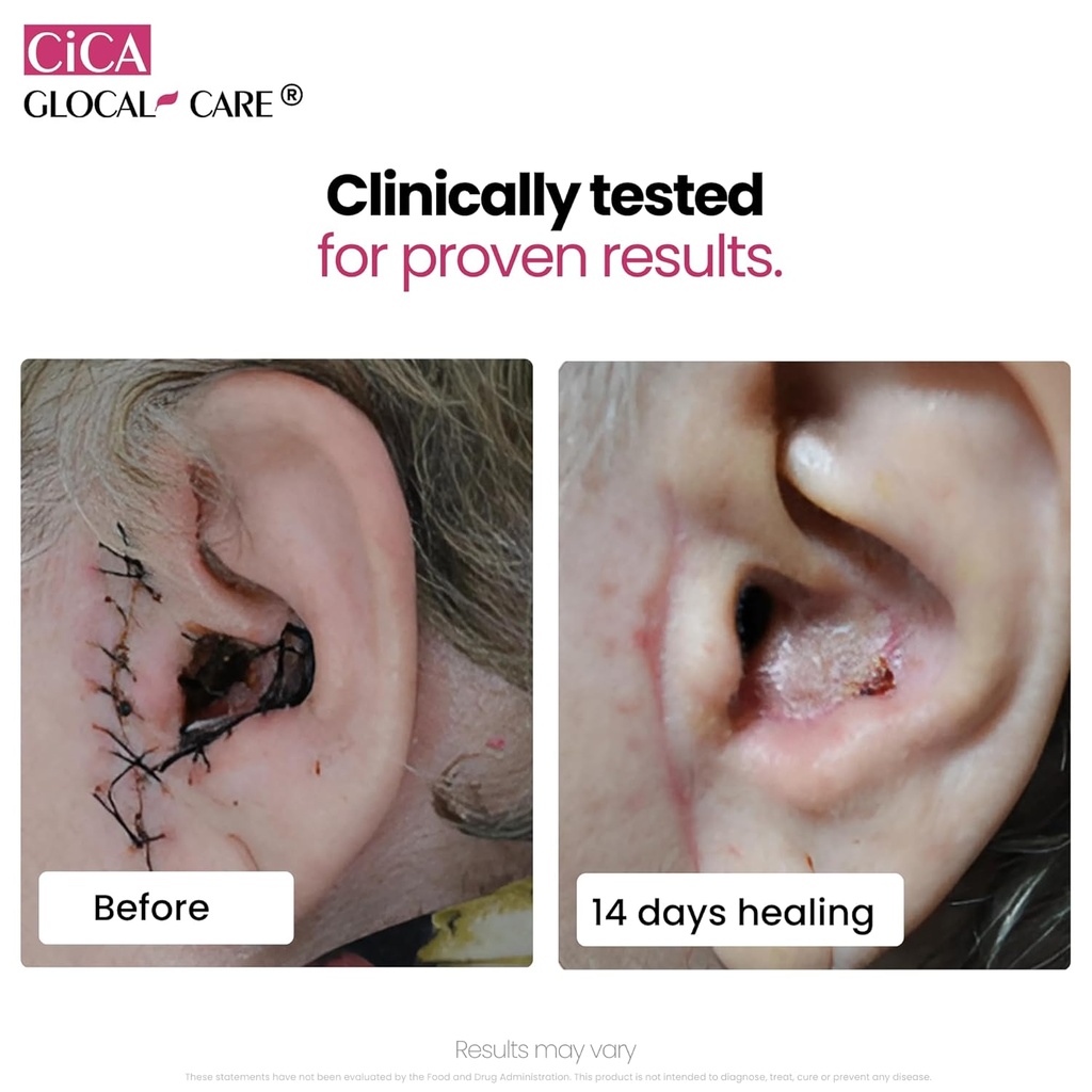 cica-glocalcare-clinically-proven-wound--6.jpg