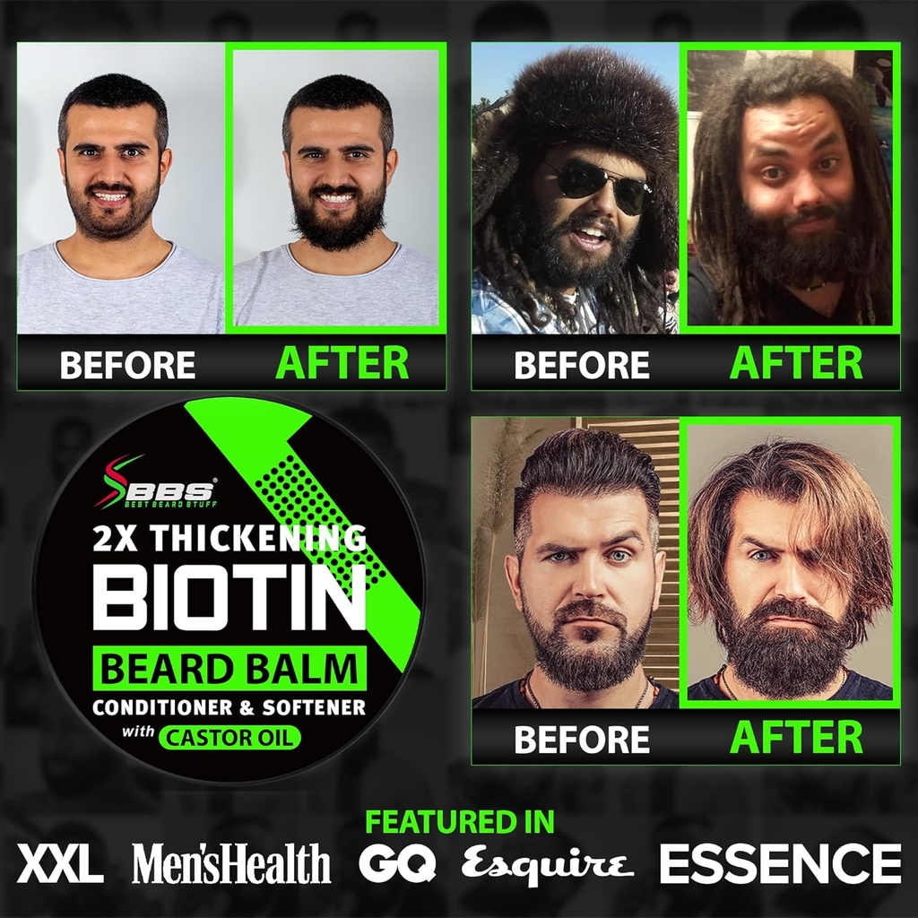 beard-growth-kit-w-2x-thickening-biotin--3.jpg