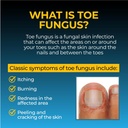 fungi-nail-anti-fungal-liquid-solution-k-4.jpg