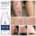 100-silicone-scar-gel-scar-cream---advan-3.jpg