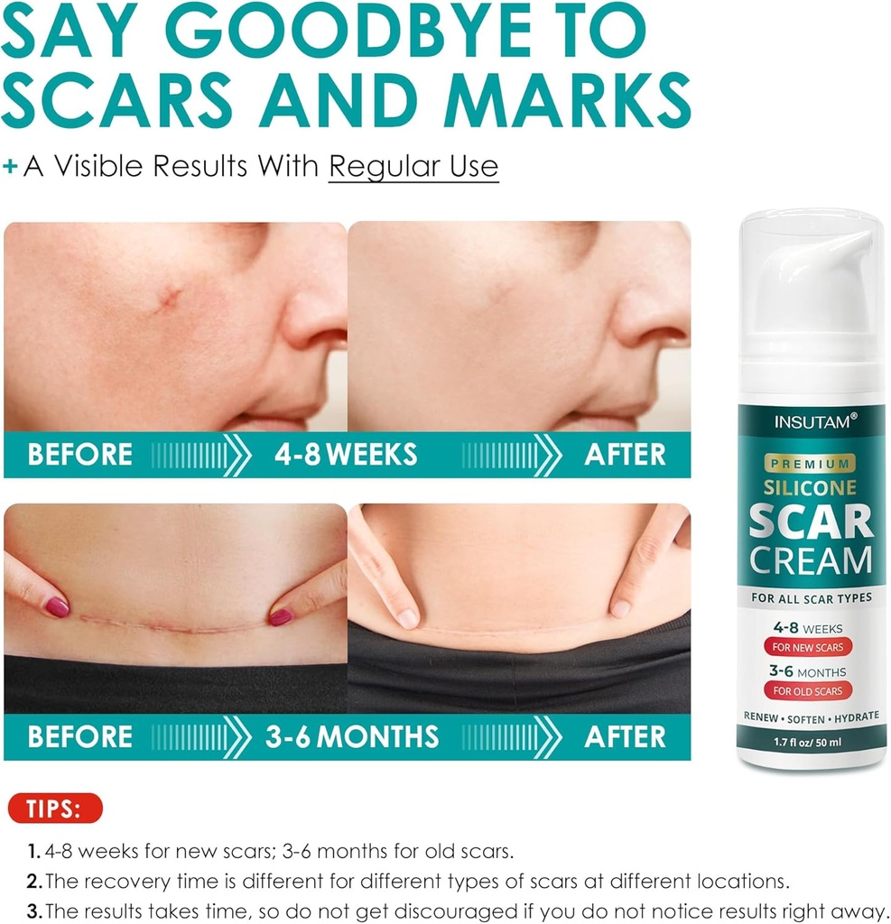 silicone-scar-gel-for-skin-scars-scar-re-5.jpg