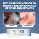 prosil-silicone-scar-stick-425g-effectiv-4.jpg