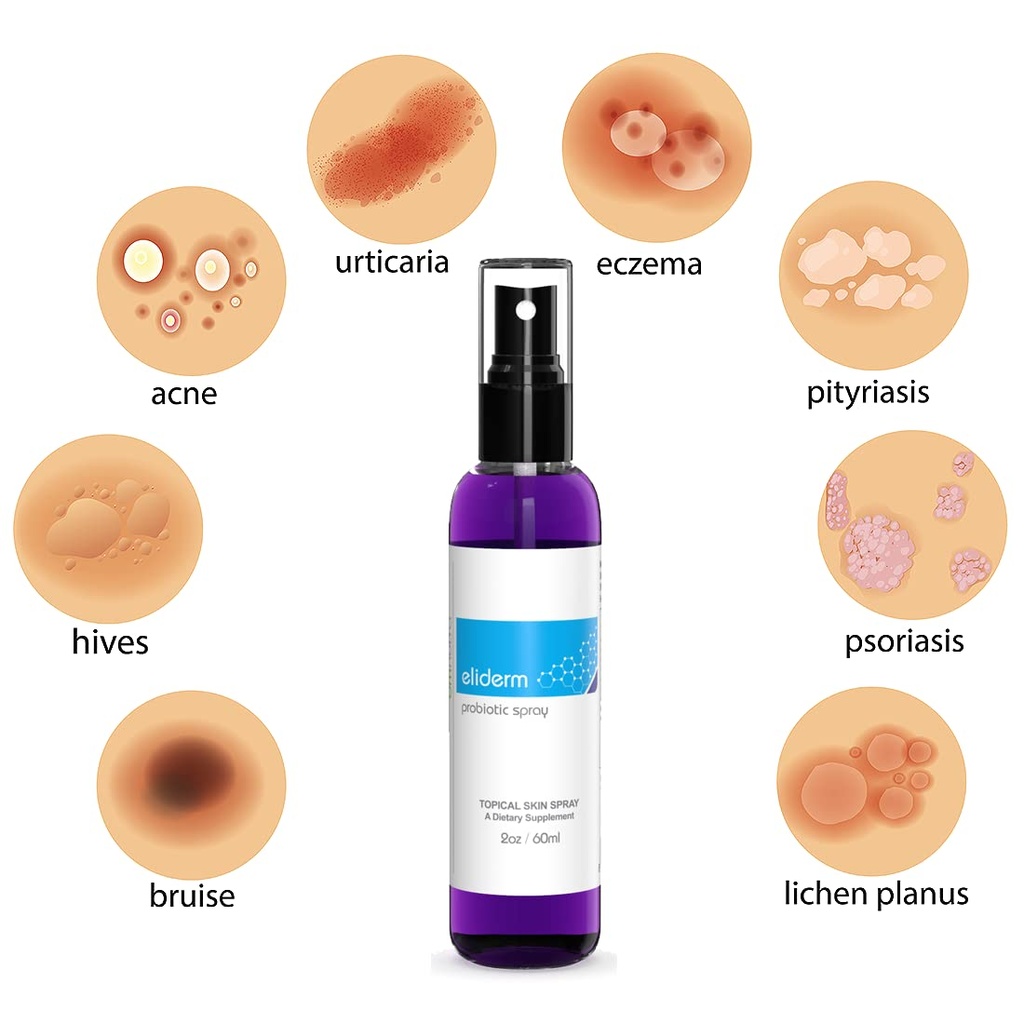 topical-probiotic-spray-for-skin---13-st-2.jpg