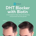 hk-vitals-dht-blocker-with-biotin-stingi-3.jpg