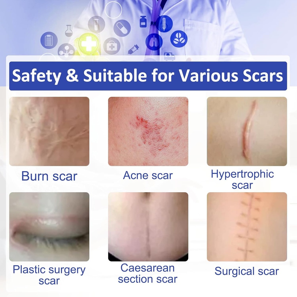 new-transparent-silicone-scar-sheets16-x-5.jpg