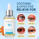 lapersonal-stye-eye-treatment-chalazion--2.jpg