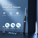 ear-wax-removal---earwax-remover-tool-wi-2.jpg