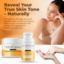 dermawonder-vitiligo-supplement-pigmenta-2.jpg