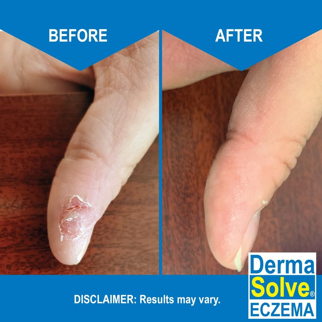 dermasolve-eczema-relief-body-wash-2-pac-4.jpg