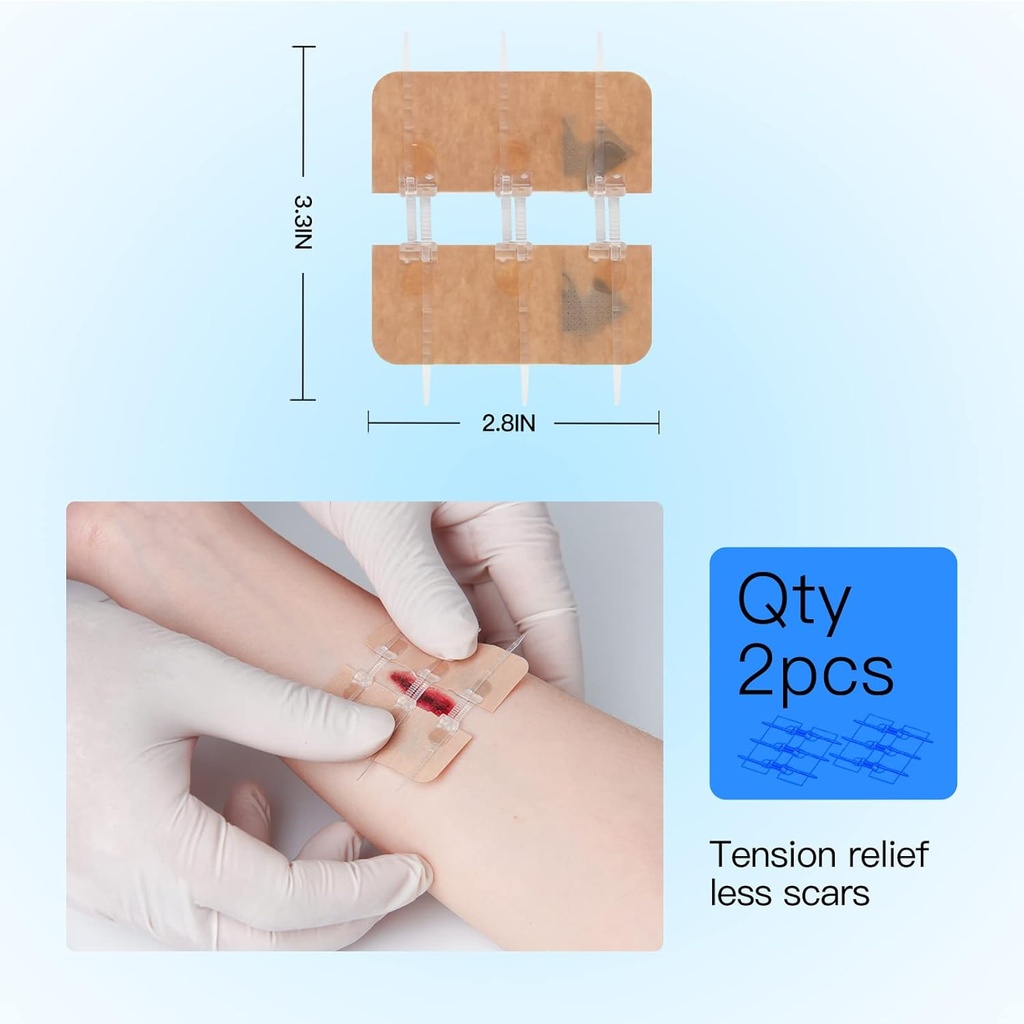 zip-stitch-laceration-repair-without-sti-5.jpg