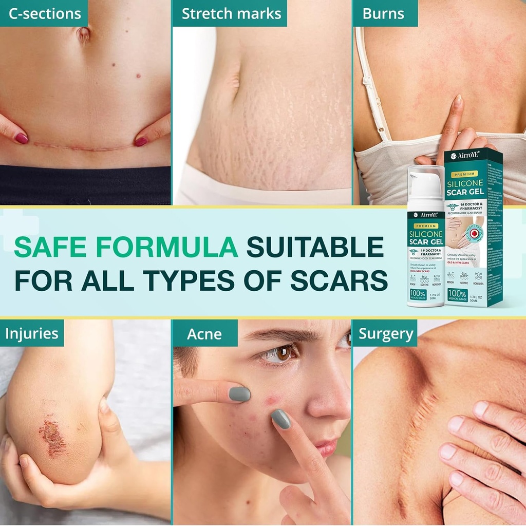 silicone-scar-gel-for-stretch-mark-100-s-6.jpg