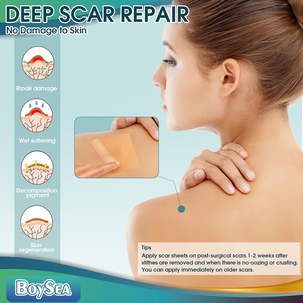 boysea-silicone-scar-sheets-16-x-120-cle-4.jpg