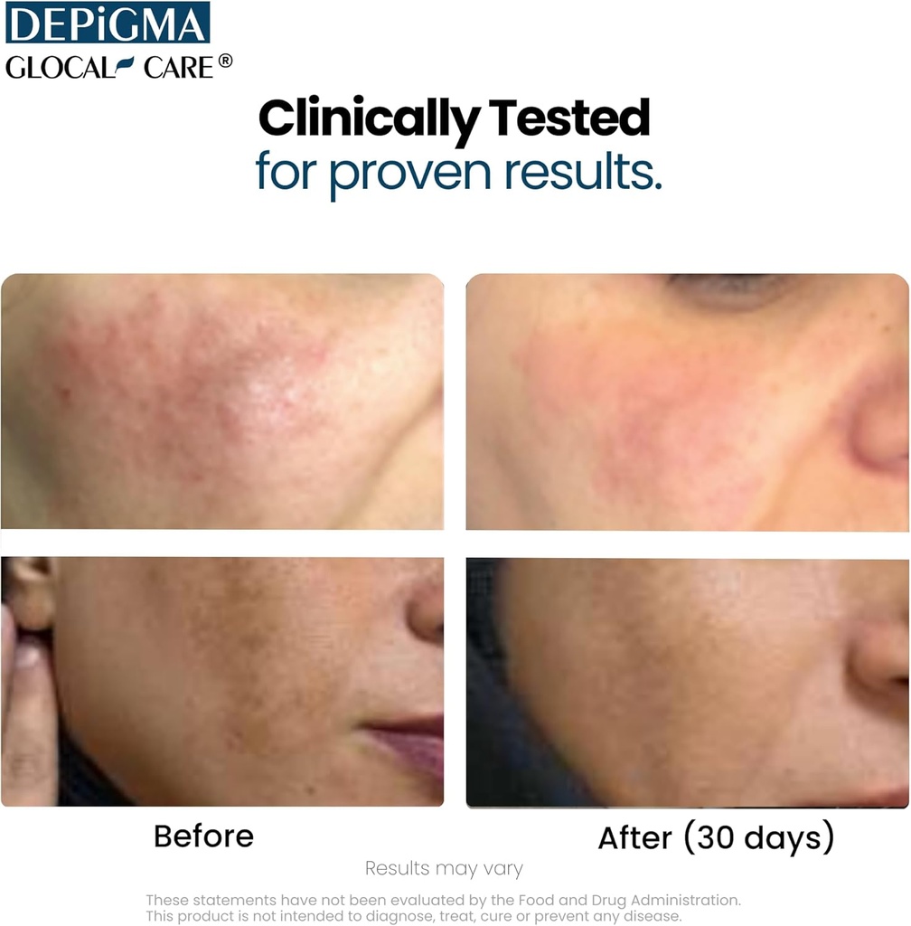 glocalcare-depigma-support-reduction-of--4.jpg