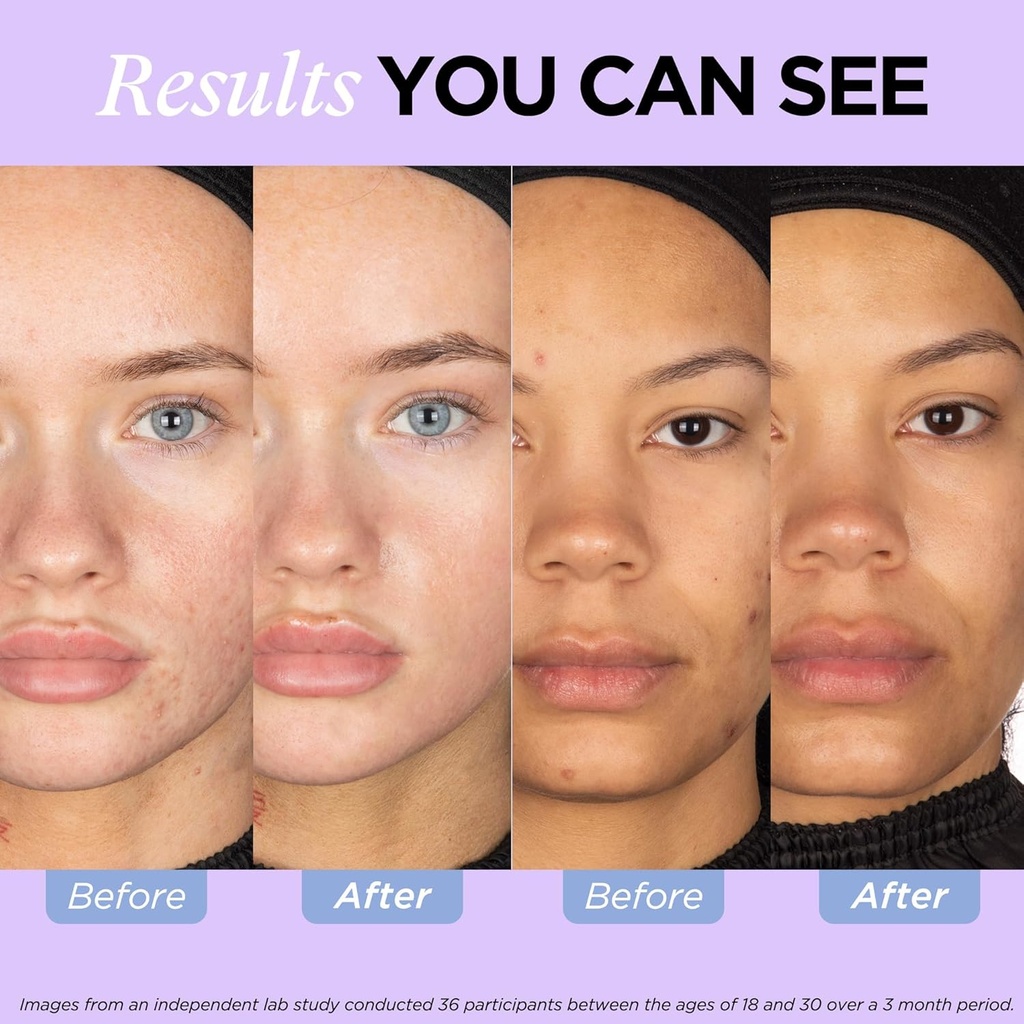 ZitSticka Vitamin Acne Supplement for Cystic Acne w/ 30 Natural Caps for Women and Men, Supplements for Hormonal Support, Skin Clarity, Dark Spots - Dermatologist Tested (After Hours Refill Pack) 5