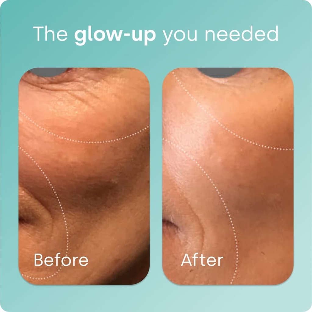 Biosil Collagen Booster Supplement - 30 Original Capsules, Pack of 2 - Patented ch-OSA Activator for Skin, Hair, Nails & Joints - Supports Natural Production - 30-Day Supply 4