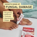 Kerasal Nail Fungus Extra Strength | Restorative Nail Repair for Damaged Nails, 0.33 fl oz (Packaging May Vary) 4