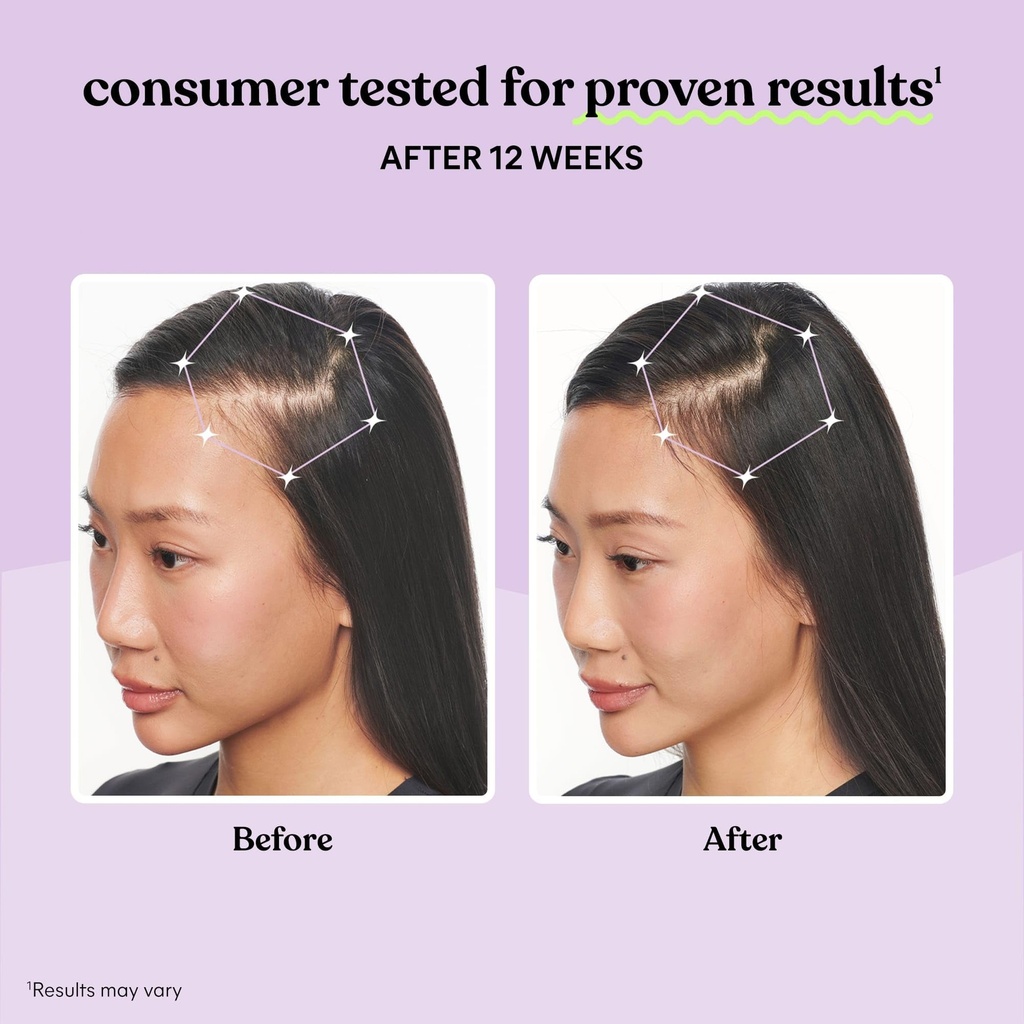 lemme-grow-hair-growth-supplement-for-wo-3.jpg