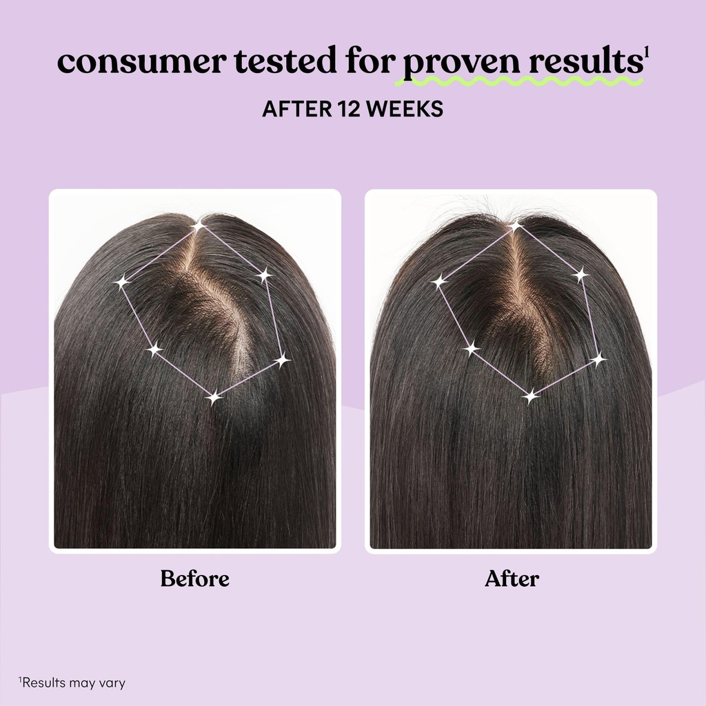 lemme-grow-hair-growth-supplement-for-wo-4.jpg