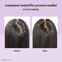 lemme-grow-hair-growth-supplement-for-wo-4.jpg
