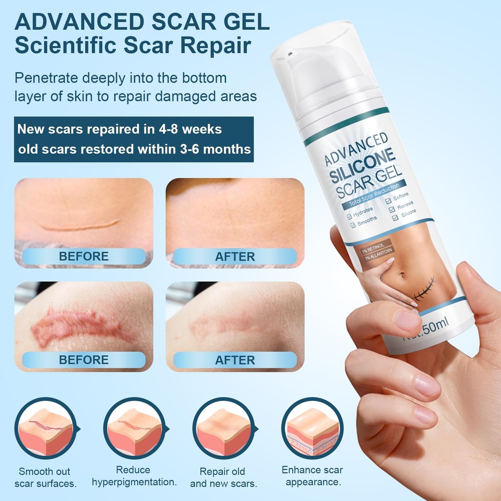 mitgary-advanced-scar-gel-silicone-scar--3.jpg