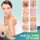 professional-silicone-scar-sheets-1-6-x--6.jpg
