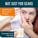 nuvadermis-silicone-scar-sheets-extra-lo-2.jpg