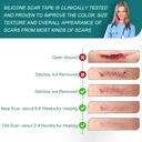 silicone-scar-sheets-1-6-x-158-roll-4m-s-6.jpg