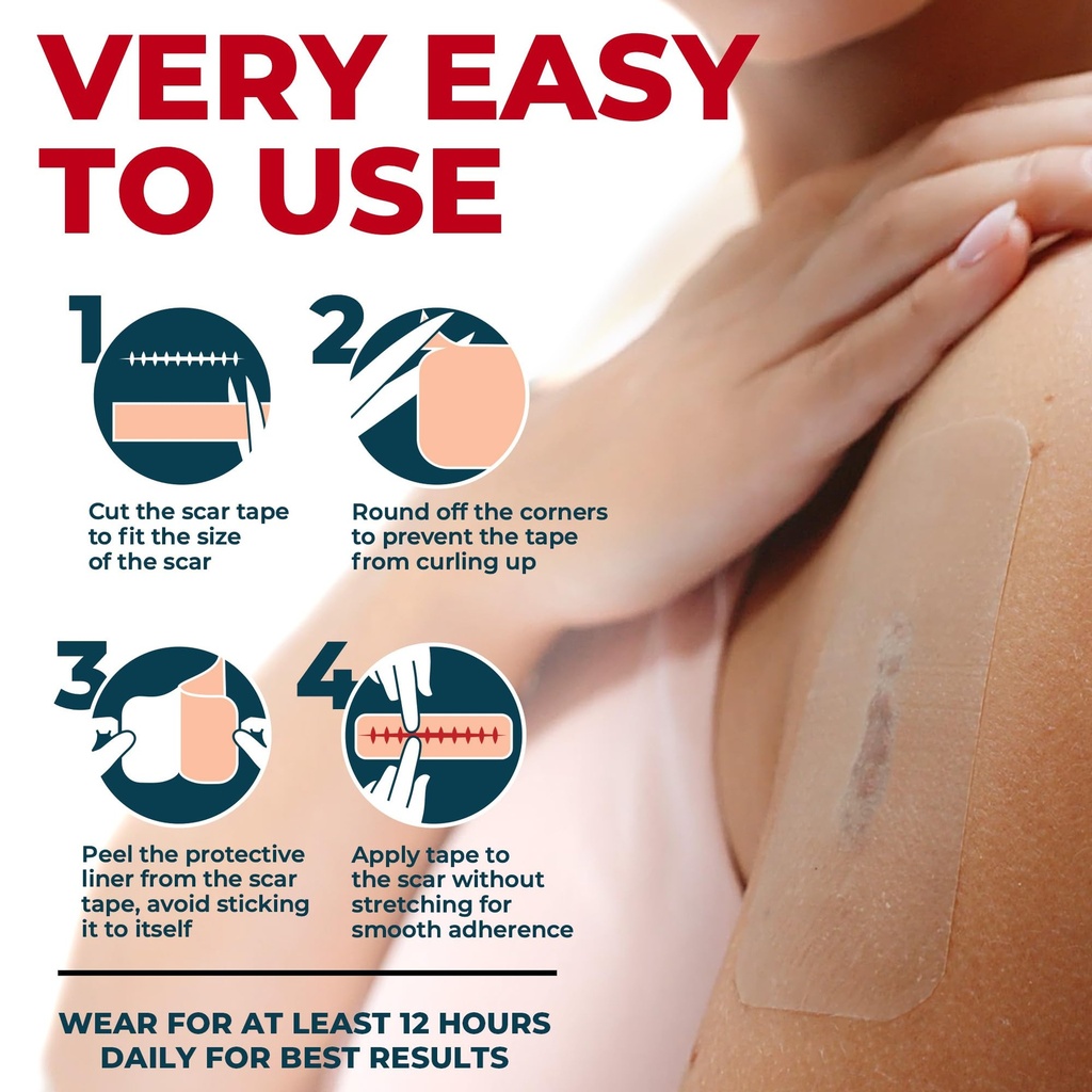 medical-grade-silicone-scar-tape-1-6-x15-6.jpg