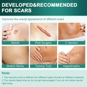 silicone-scar-sheets-silicone-scar-tape--4.jpg